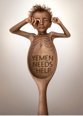 Yemen Needs Help